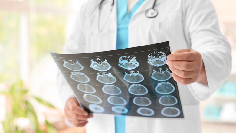 Doctor holding brain X-ray