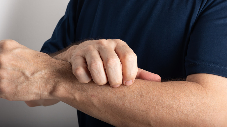 A middle-aged man scratching his forearm