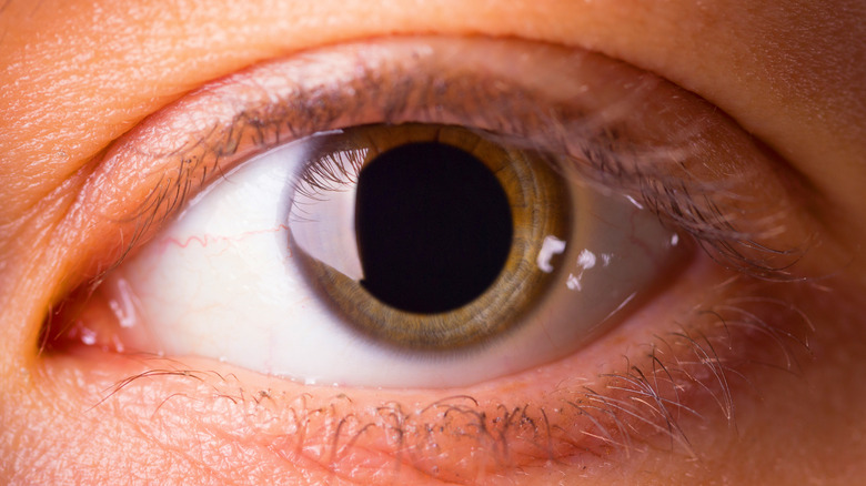 close up of eye with dilated pupil