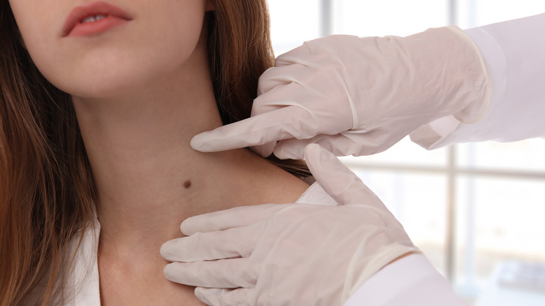 Dermatologist examining woman