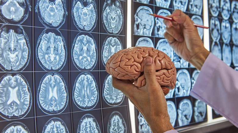 doctor holding model of brain