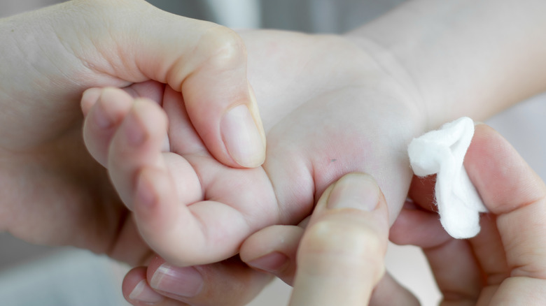 Hand examining a child's hand with a splinter lodged in their palm