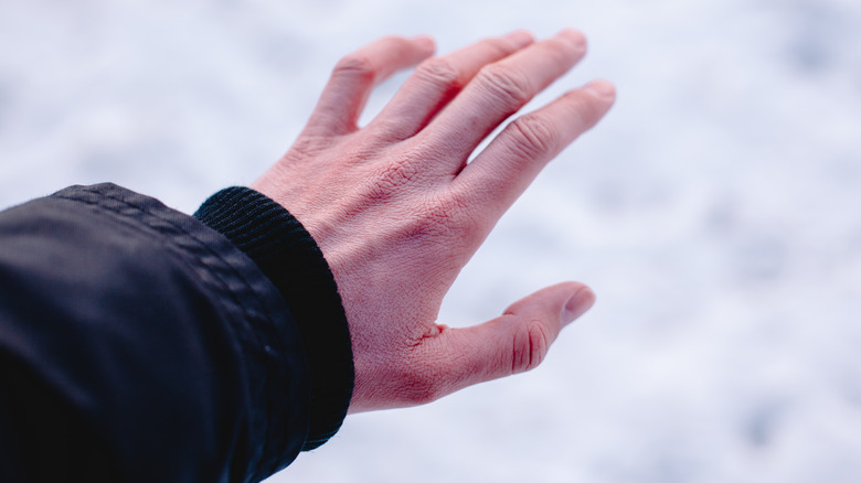 Chapped red hand out in snow