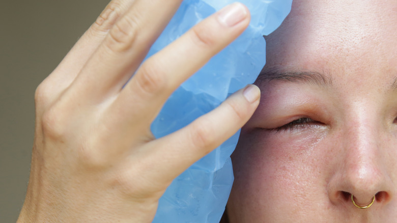 woman icing her eye