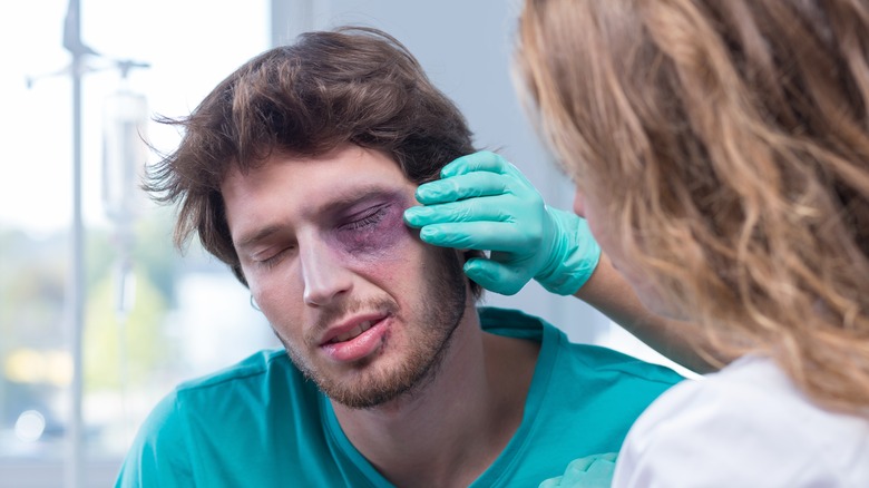 Doctor examining man's black eye