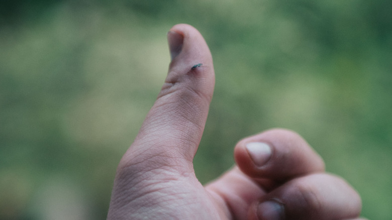 Finger with splinter unfocused green background