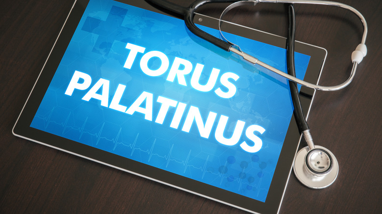 tablet with 'torus palatinus' written on it 