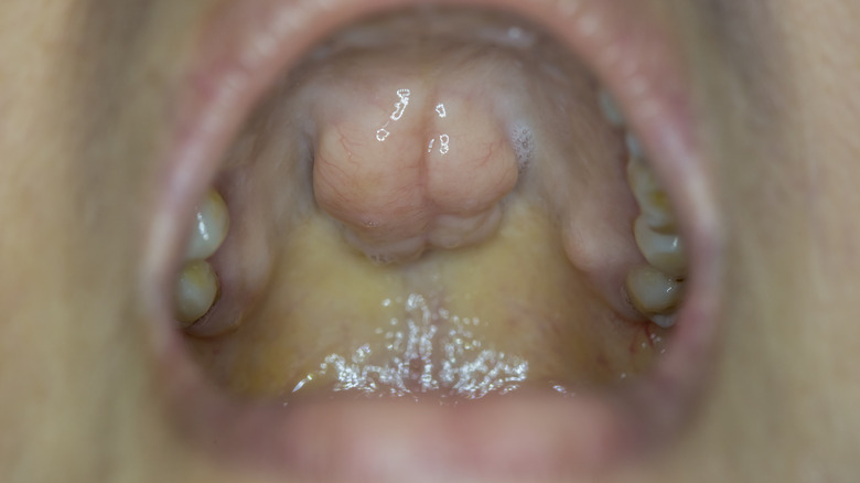 a person with an open mouth showing TP 