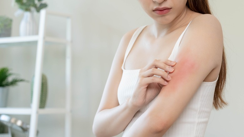 woman with reddened skin