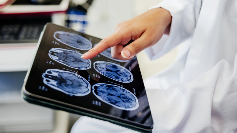 A doctor looking at scans of a patient's brain