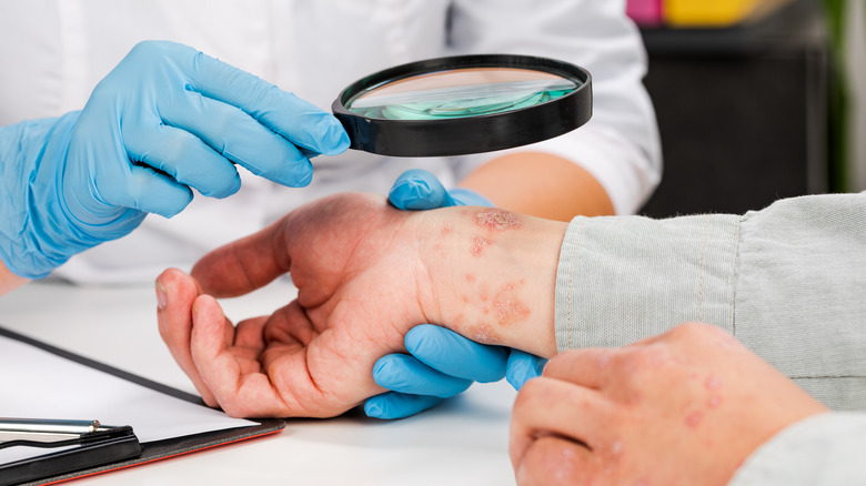 medical professional examining a patients wrist 