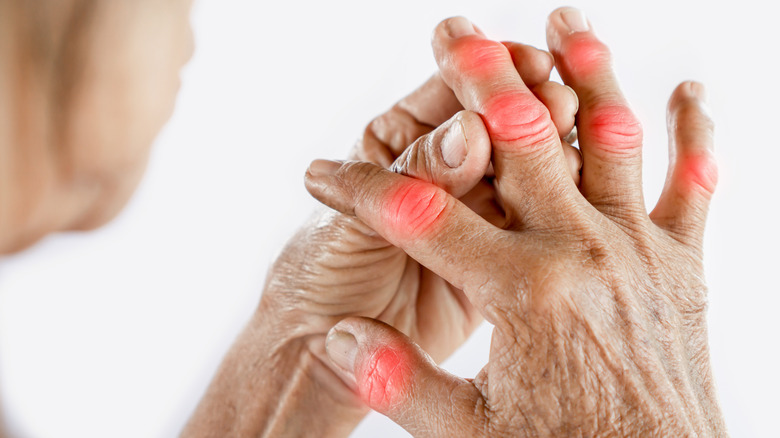 Hand pain with rheumatoid arthritis