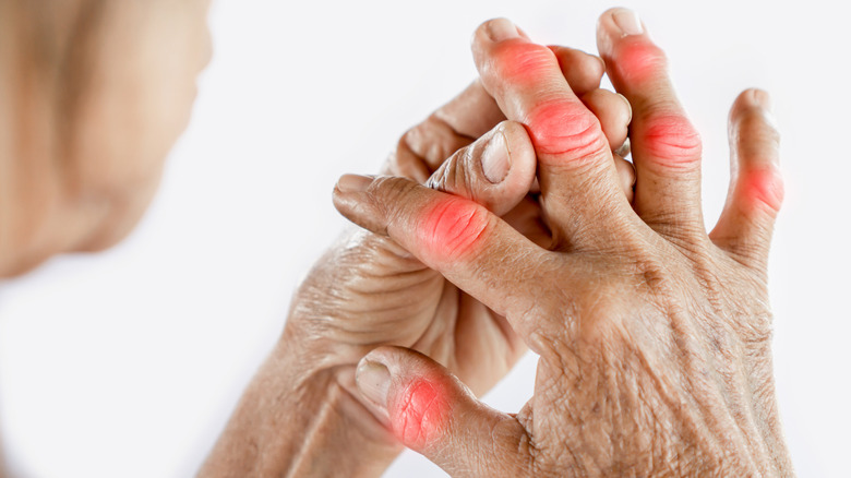 Hand pain with rheumatoid arthritis