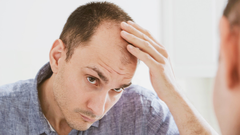 Man balding looking in mirror