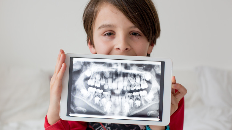 Young boy holding dental x-ray in front of him