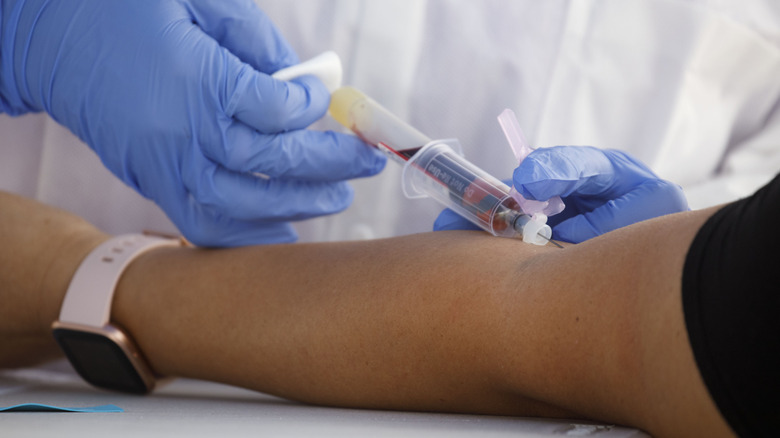 Blood being drawn from patient's arm