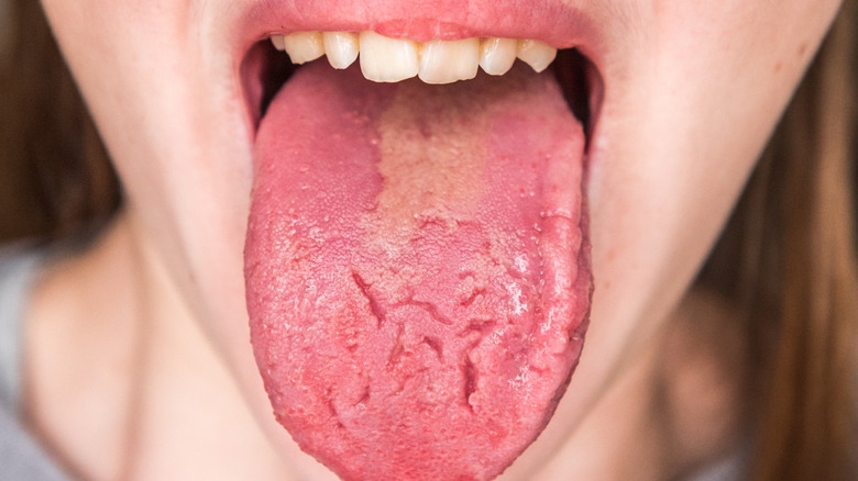 Close-up of tongue with cracks