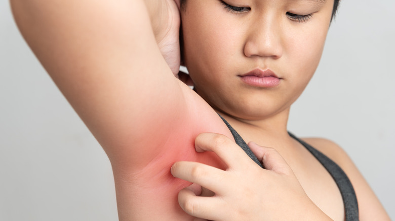 Woman scratching her armpit causing redness