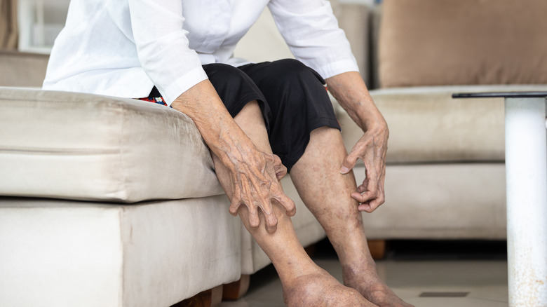 Senior woman scratching legs