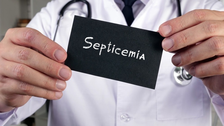 doctor holding card that reads 'septicemia'