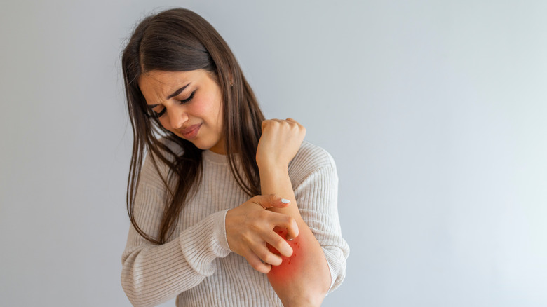 woman uncomfortably scratching elbow