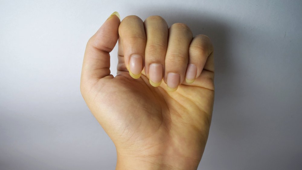 yellowed fingernails