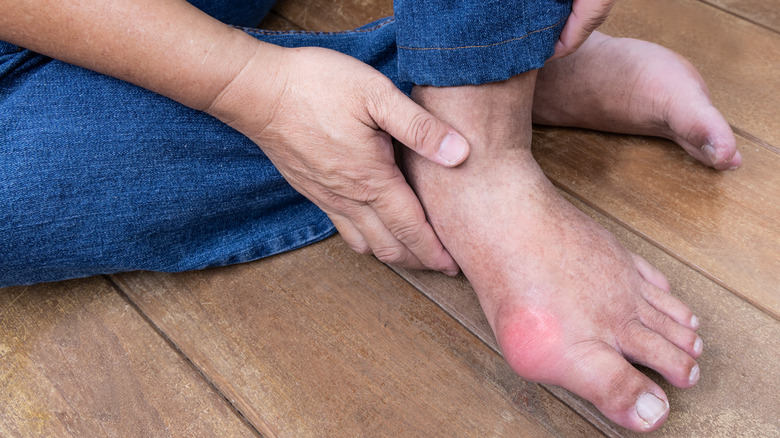 Gout attack in the foot 