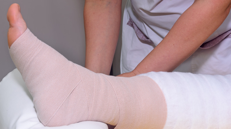 wrapped leg of lymphedema patient