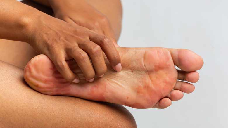 Person scratching athlete's foof