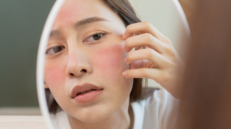 woman looking at rashes in mirror