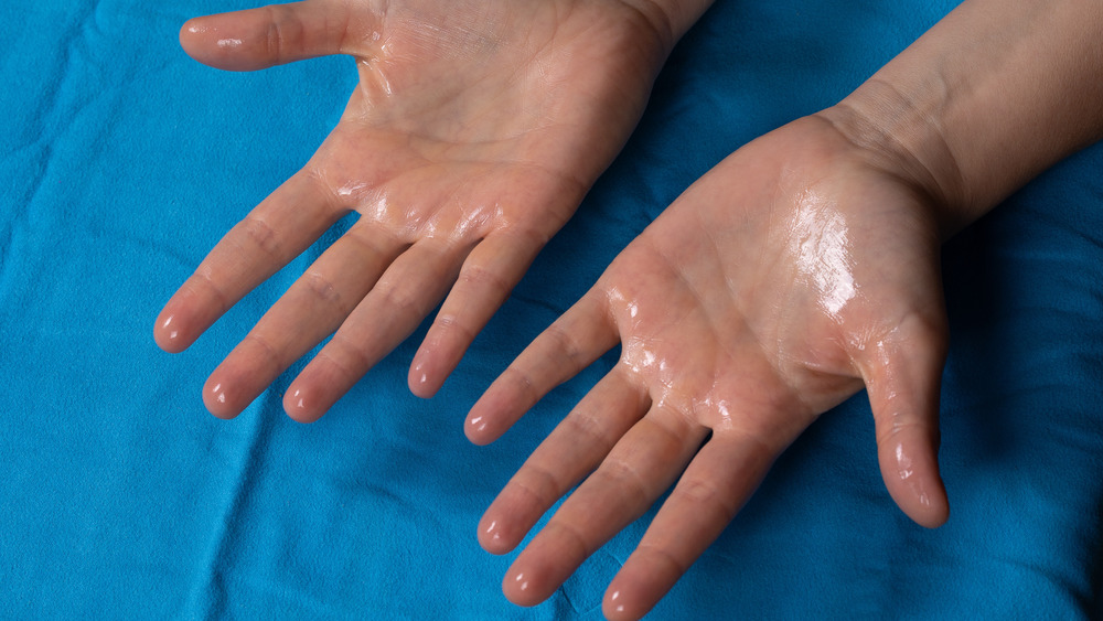 hyperhidrosis of the hands