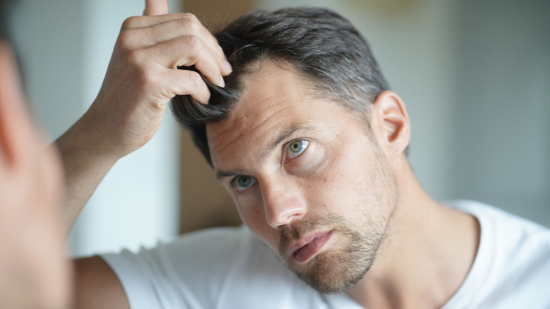 Scalp of man with pattern hair loss 