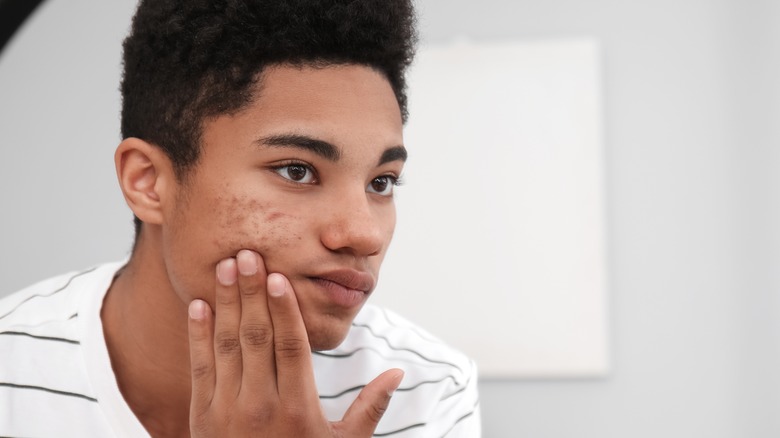 teenager examines acne in mirror