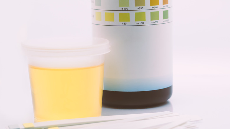 urine sample in cup