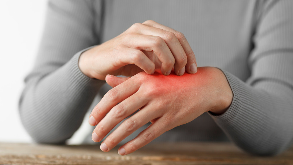 Woman with an irritated wrist