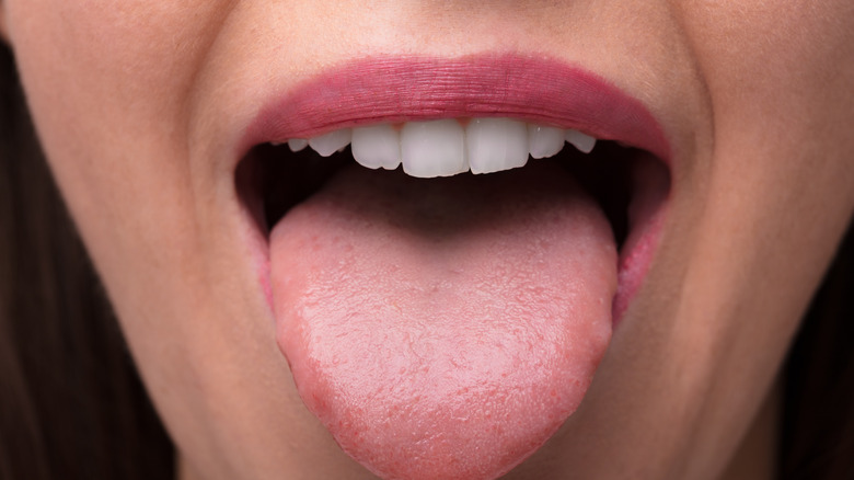 woman with healthy tongue 