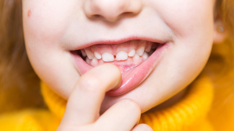 Little girl with an overbite