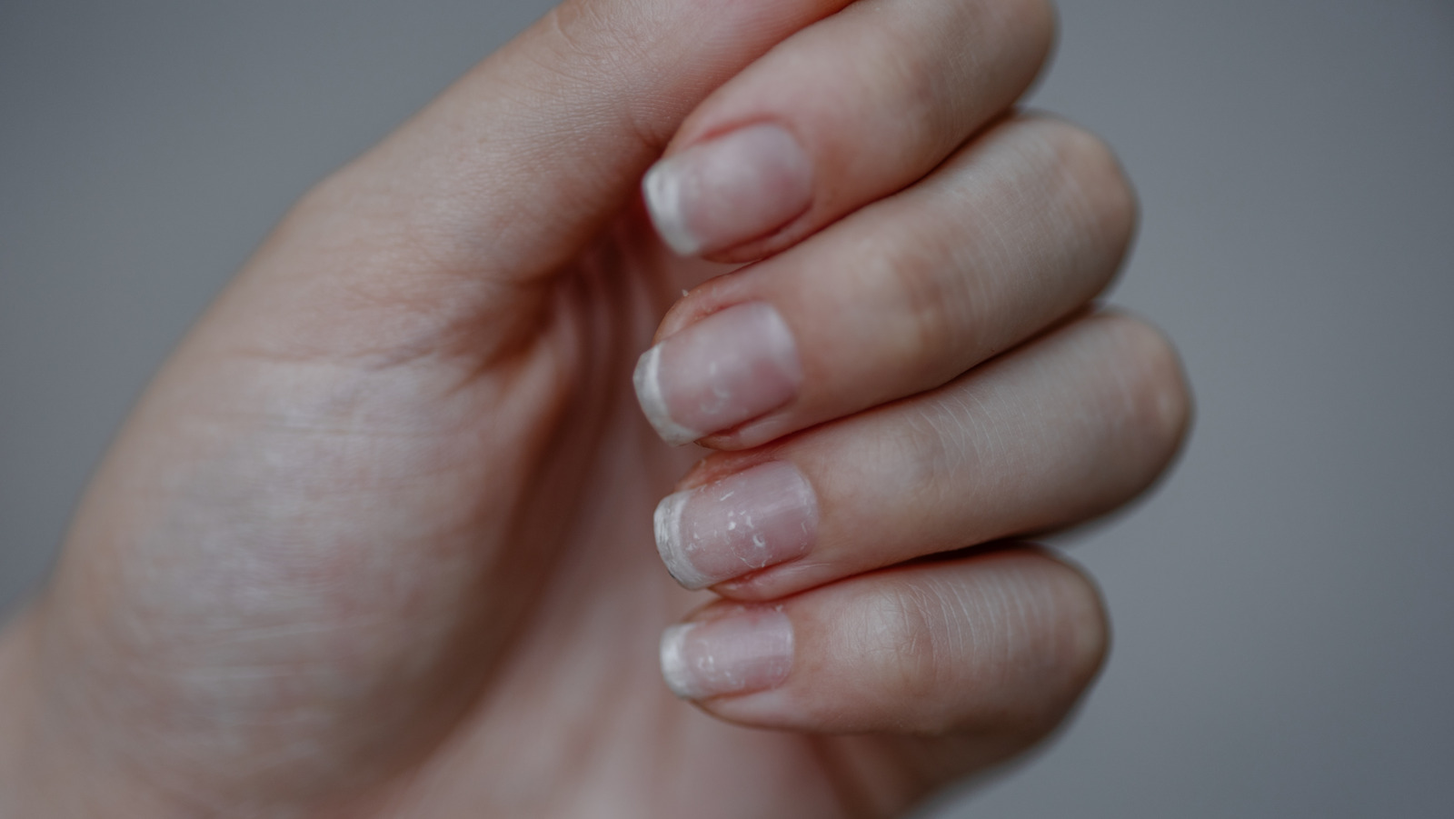 This Is What Really Causes Brittle Nails This Is What Really Causes Brittle Nails