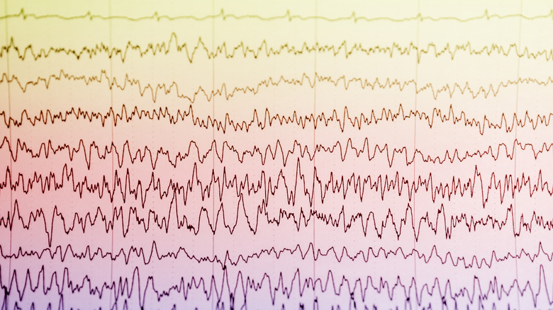 visual recording of EEG test