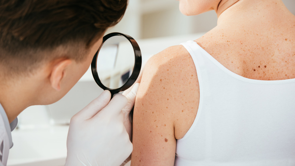Dermatologist examining a woman's skin