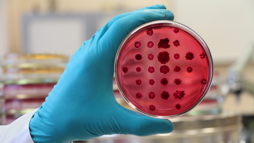 Gloved hand holding petri dish with bacteria growing on it