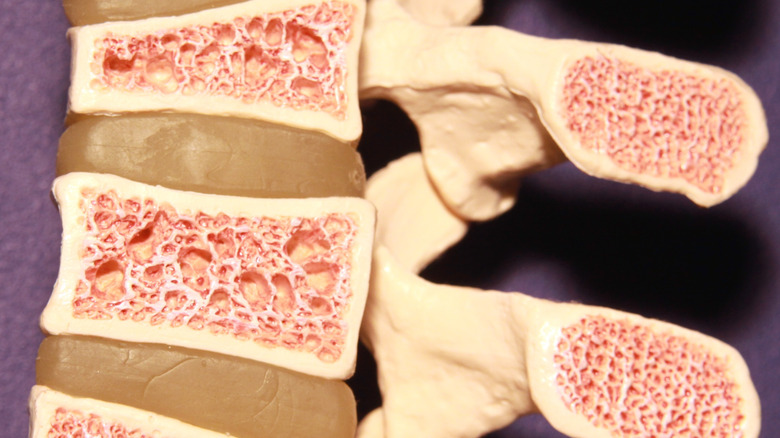 Model of bone