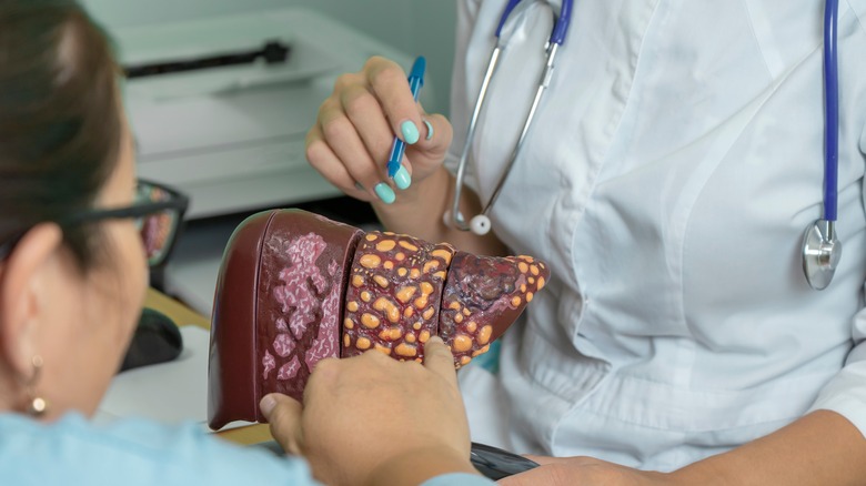 Doctor showing patient liver model