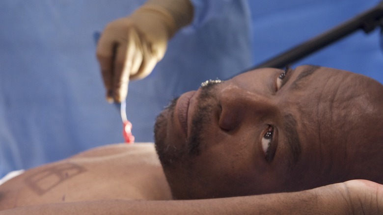 Man getting plastic surgery