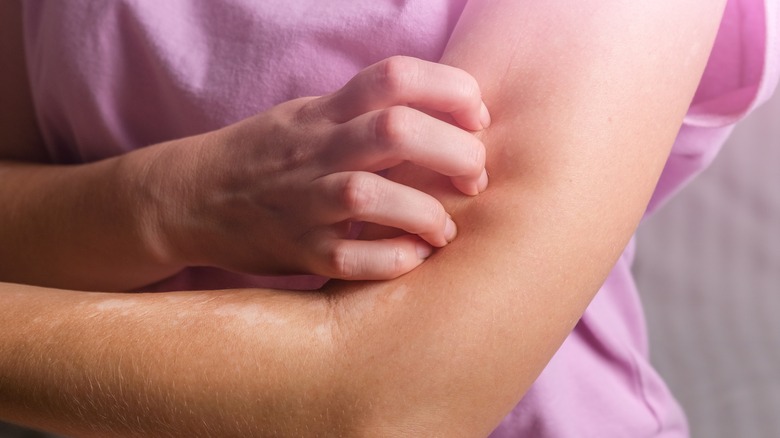 Eight Skin Rashes You Need to Know