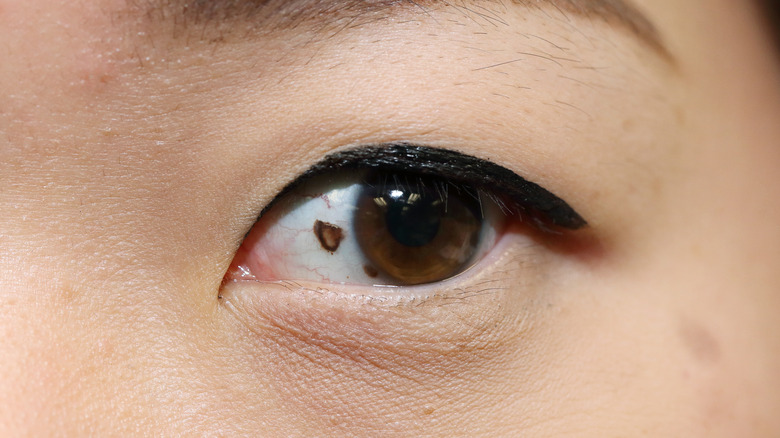 Types Of Vision Loss Explained
