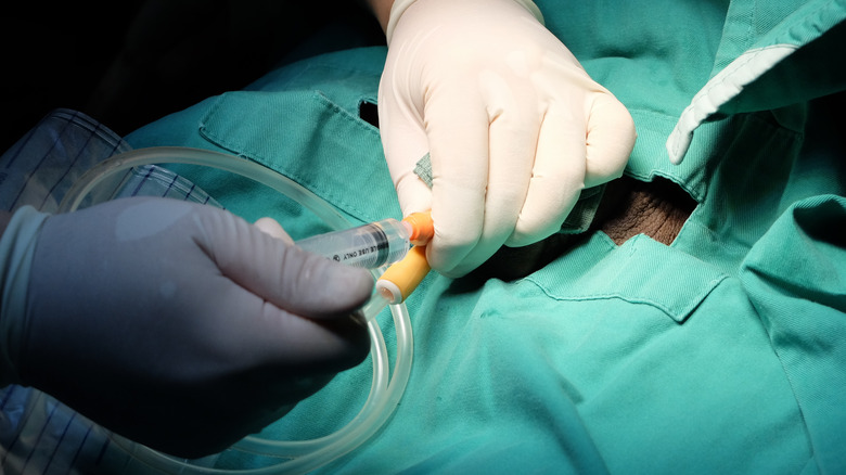 doctor inserting a catheter