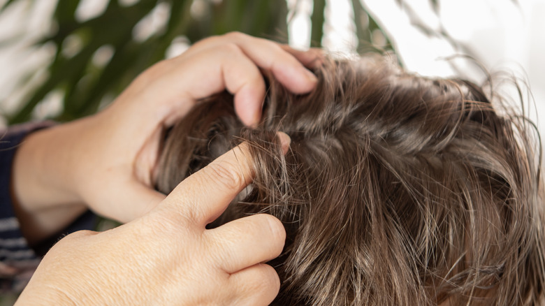 Hands searching for head lice in a person's scalp