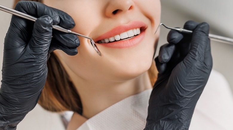 woman getting veneers