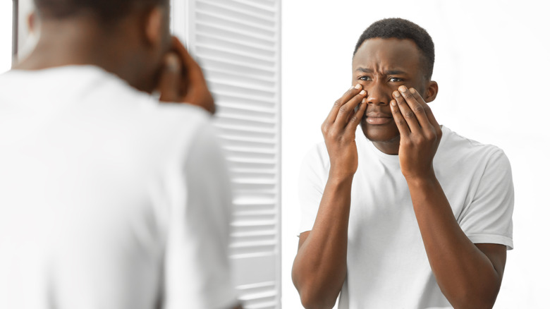 man with puffy eyes